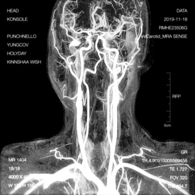 Album cover art for Head