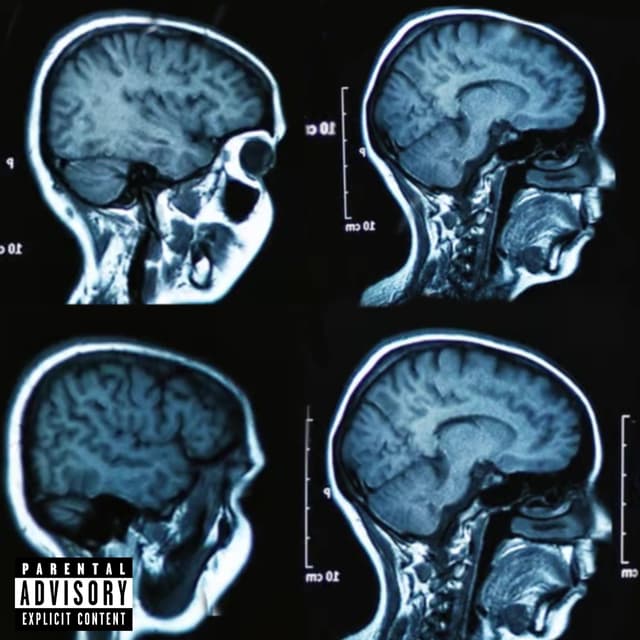 Album cover art for Mind Games: It’s All In Your Head