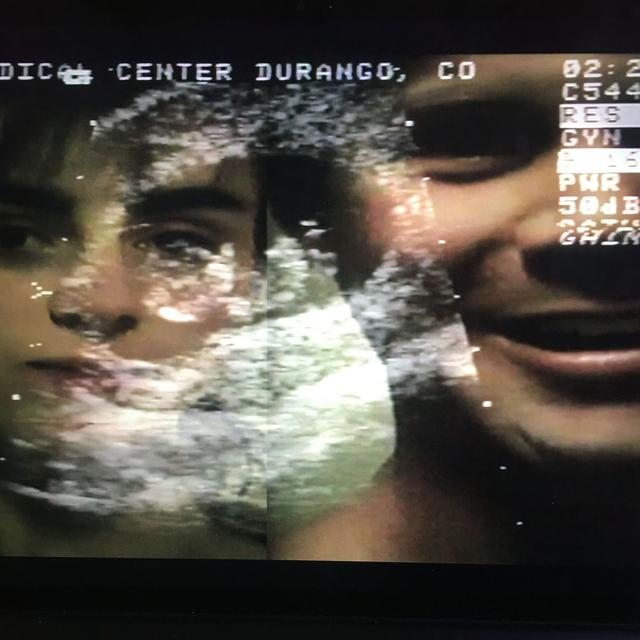 Album cover art for Ssx