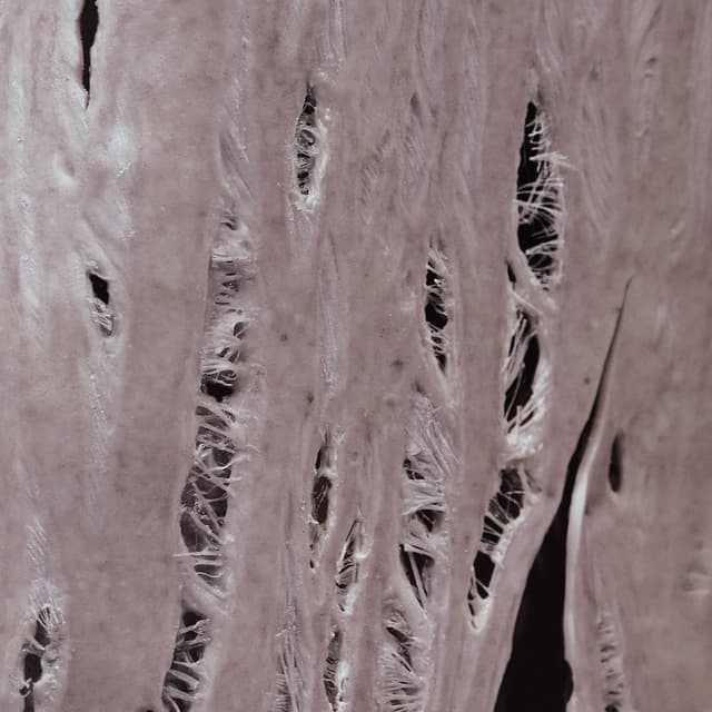 Album cover art for Torn